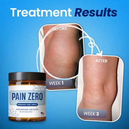 ⭐️Clemyro® Pain Zero Magnesium Formula